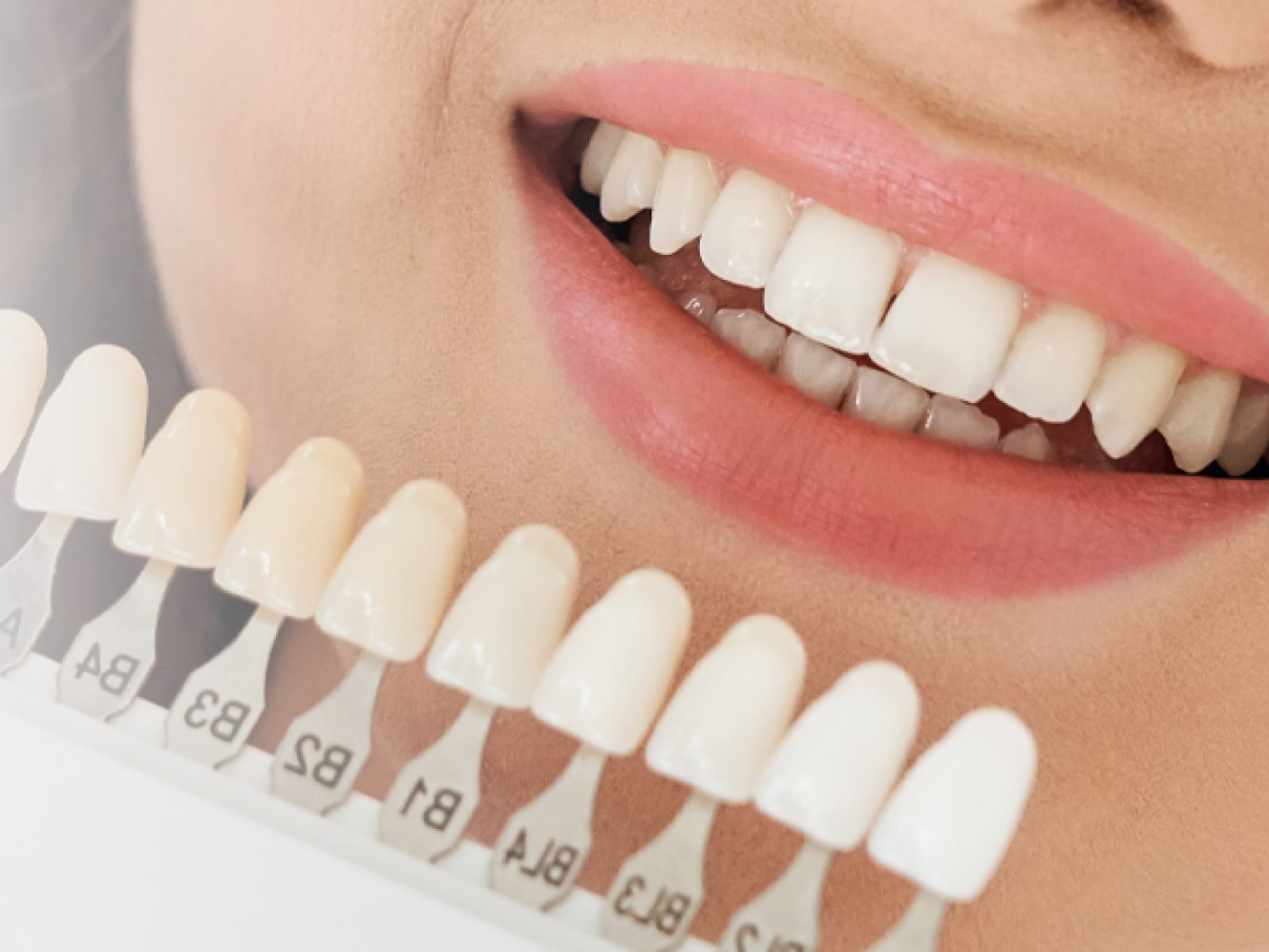 Отбеливание зубов