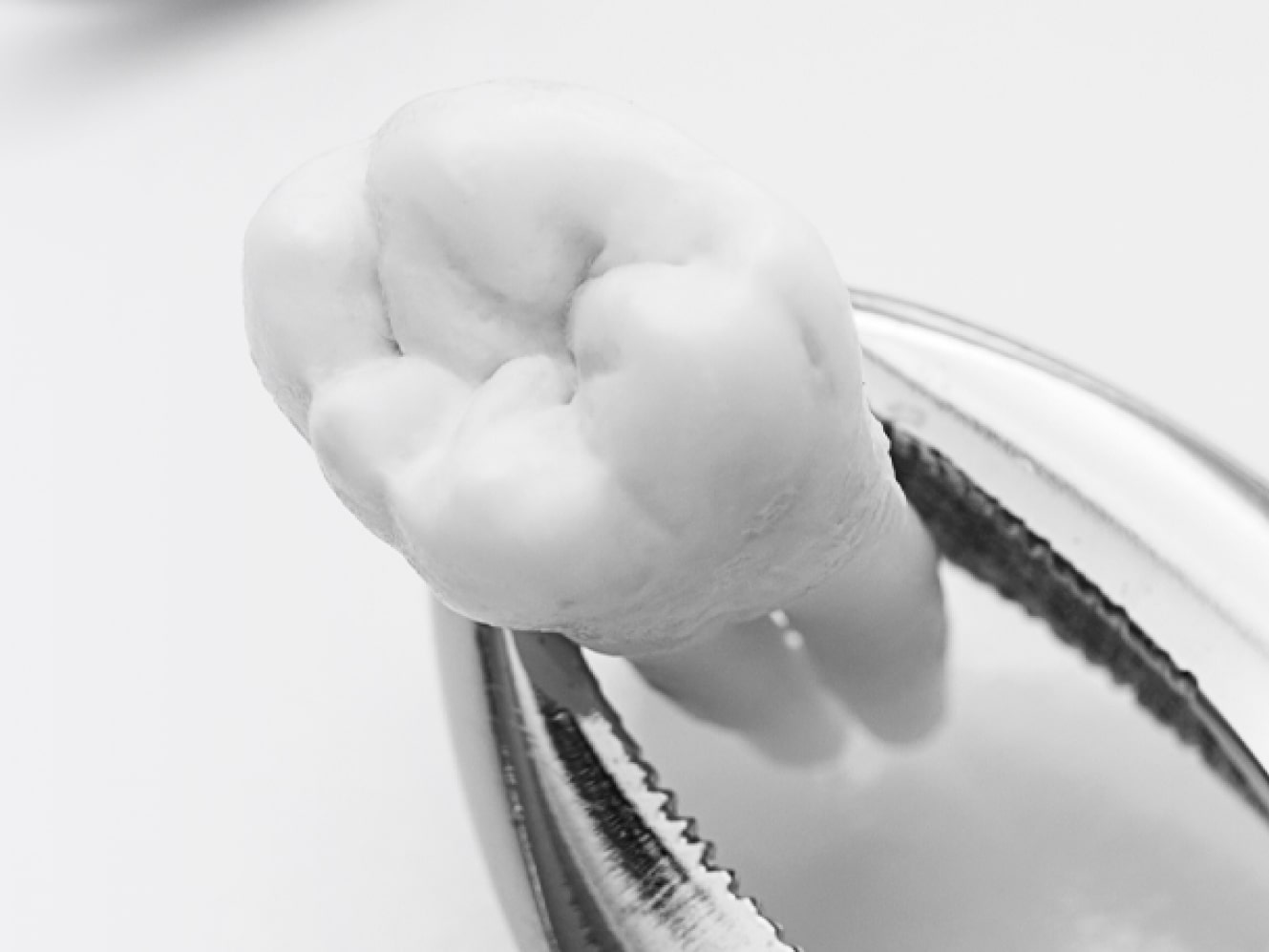 Удаление зубов